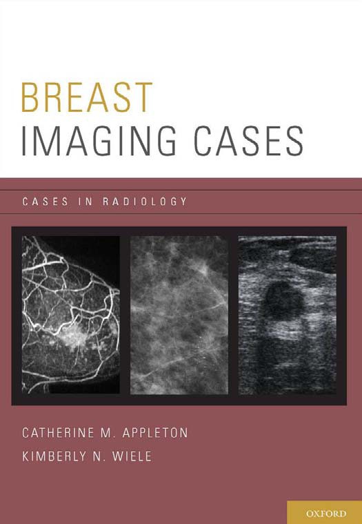Cases In Radiology - Breast Imaging Cases